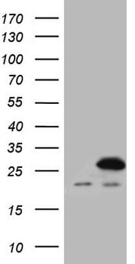 Monoclonal Mouse anti-Human SPCS2 Antibody (clone OTI1E4, aa2-64, WB)