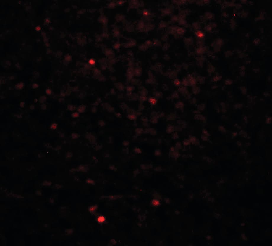 IHC-plus™ Polyclonal Rabbit anti-Human CLEC7A / Dectin 1 Antibody (IHC, IF, WB)