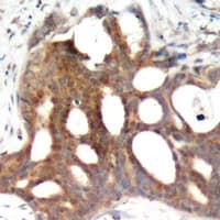 Polyclonal Rabbit anti-Human ER Alpha / Estrogen Receptor Antibody (phospho-Ser104, IHC, WB)