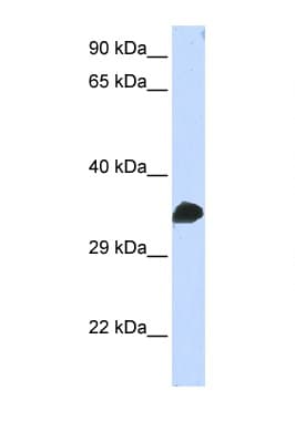 CDK1 / CDC2 Antibody (N-Terminus)