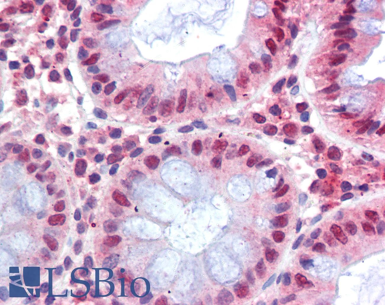 IHC-plus™ MBD2 Antibody (aa15-29)