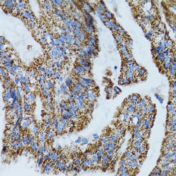 Polyclonal Rabbit anti-Human MRPL28 Antibody (IHC, IF, WB)