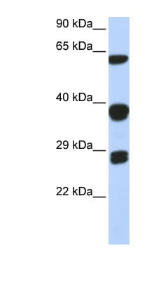 SNRPB / COD Antibody (aa72-121)