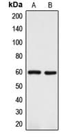 DCT / Dopachrome Tautomerase Antibody (Internal)