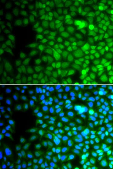 ZNF195 Antibody