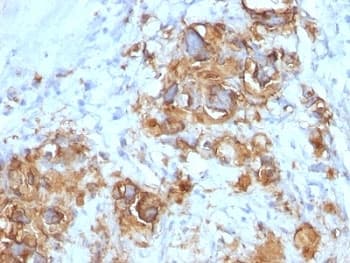 Sialylated Lewis a / CA 19-9 Antibody (clone 121SLE, Ready-to-Use)