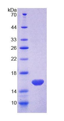 Human MARS Protein (Recombinant His-T7, N-terminus)