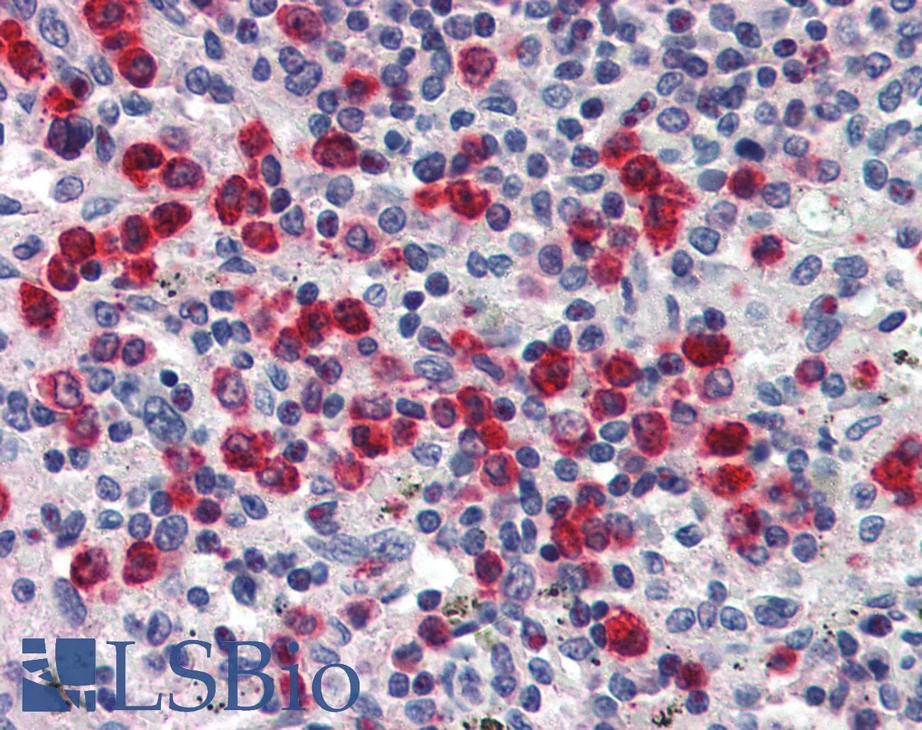 IHC-plus™ Polyclonal Goat anti-Human LCN2 / Lipocalin 2 / NGAL Antibody (aa60-72, IHC, WB)