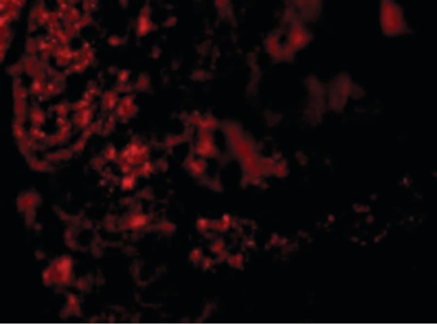 IHC-plus™ AGTR1 / AT1 Receptor Antibody
