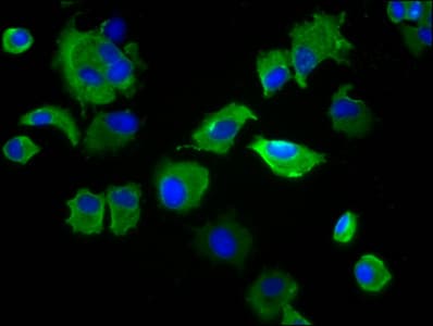 Polyclonal Rabbit anti-Human SIRPA / CD172a Antibody (IHC, IF)