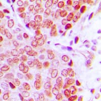 ZNF134 Antibody (Internal)