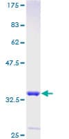 Human LARP7 Protein (Recombinant GST)
