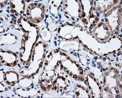 Monoclonal Mouse anti-Human SATB1 Antibody (clone OTI11E8, IHC, IF, WB)