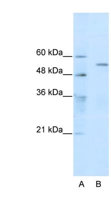 TRIM35 Antibody (aa145-194)