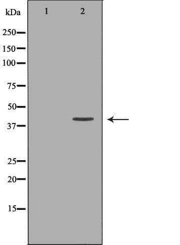 DTNBP1 / Dysbindin Antibody