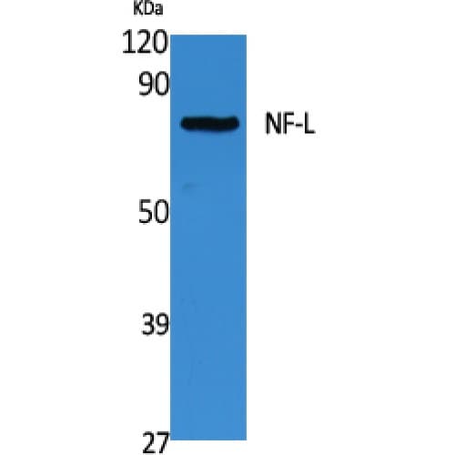 NF-L / NEFL Antibody (C-terminal)