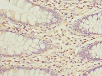 GALNT2 Antibody