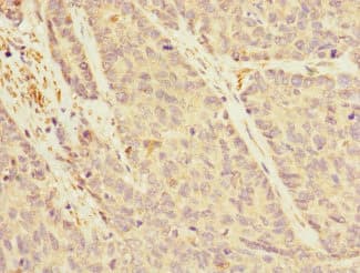Polyclonal Rabbit anti-Human IQGAP3 Antibody (IHC)