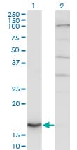 IHC-plus™ Monoclonal Mouse anti-Human CYB5A / Cytochrome b5 Antibody (clone 1A8, IHC, WB)