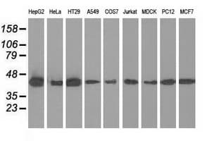 IVD Antibody (clone OTI1B10)