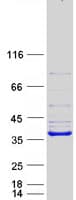 Human ARH / LDLRAP1 Protein (Recombinant Myc-DDK (Flag))