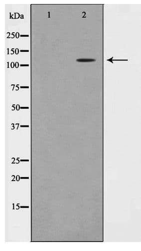 Polyclonal Rabbit anti-Human TAF4 Antibody (WB)