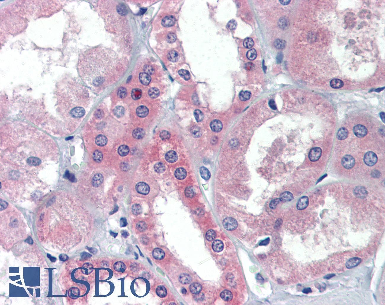 IHC-plus™ BRCC3 / BRCC36 Antibody (clone AT3B1)