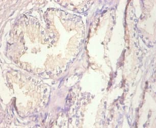 MT1A / Metallothionein 1A Antibody