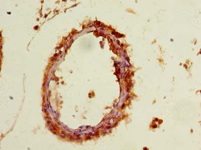 P5CR2 / PYCR2 Antibody