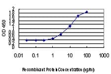 IHC-plus™ Monoclonal Mouse anti-Human DLX2 Antibody (clone 2C8, IHC, WB)