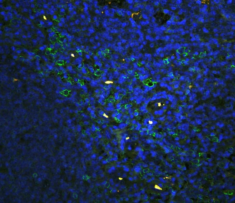 Polyclonal Rabbit anti-Human SPN / CD43 Antibody (aa272-400, IHC, WB)