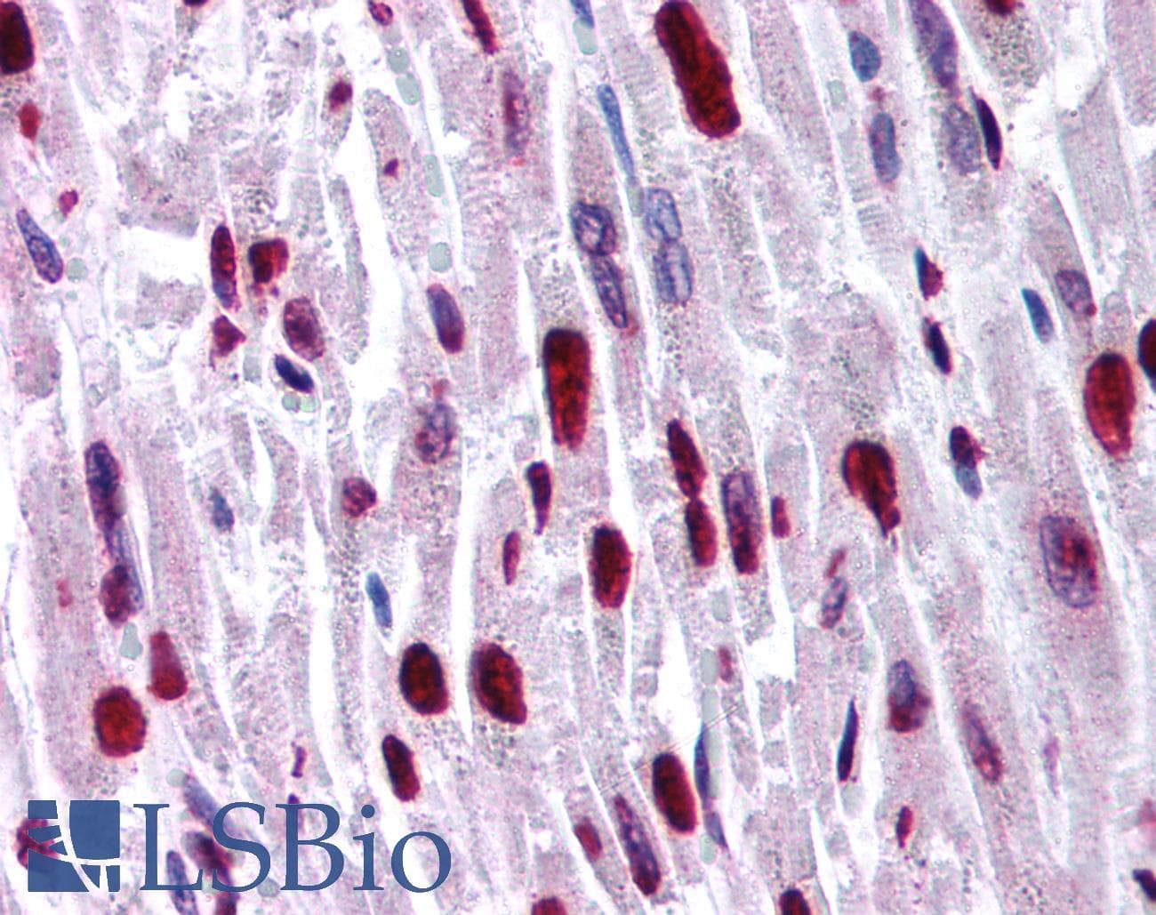 HIPK2 Antibody (aa384-433)