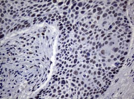 NBN / Nibrin Antibody (clone OTI8E6)