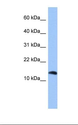 Polyclonal Rabbit anti-Human PTH2 / Parathyroid Hormone 2 Antibody (C-Terminus, WB)