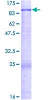 Human EHHADH / Enoyl-Coa Hydratase Protein (Recombinant GST)