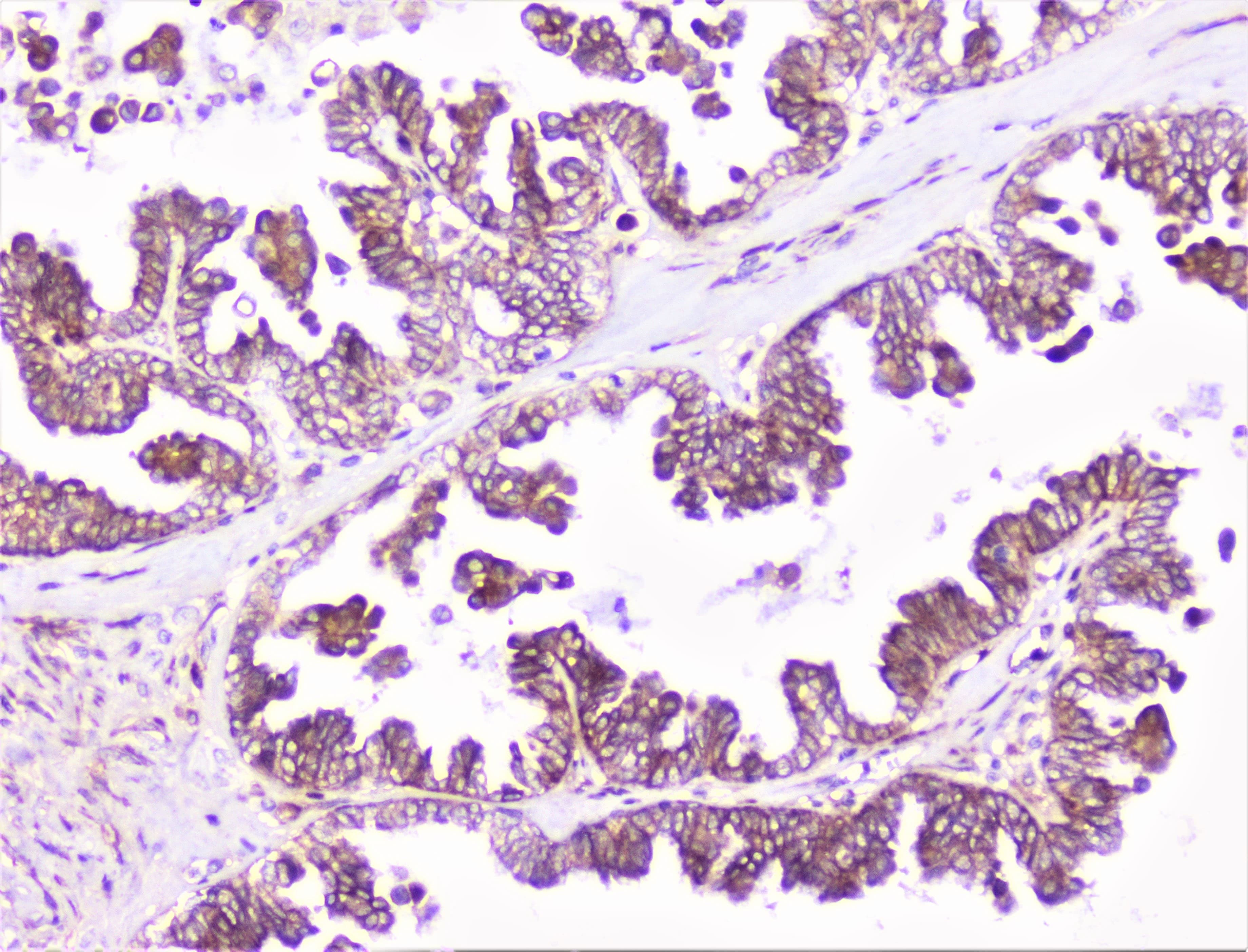 COMP / THBS5 Antibody
