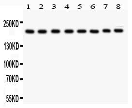 Polyclonal Rabbit anti-Human TJP1 / ZO-1 Antibody (aa1178-1527, IHC, WB)