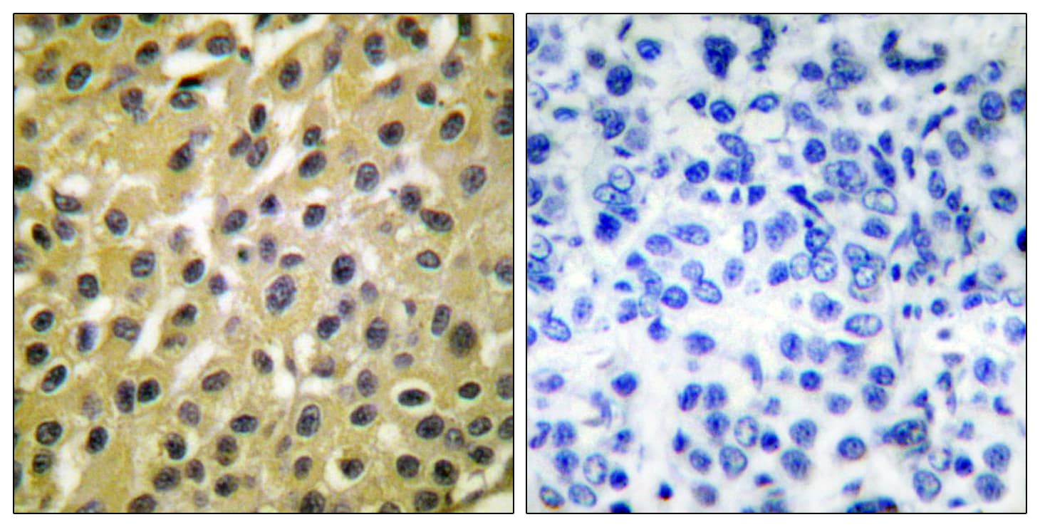 MDM2 Antibody (aa391-440)