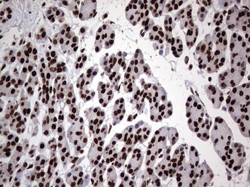 HNRNPL / hnRNP L Antibody (aa270-502, clone OTI9F11)