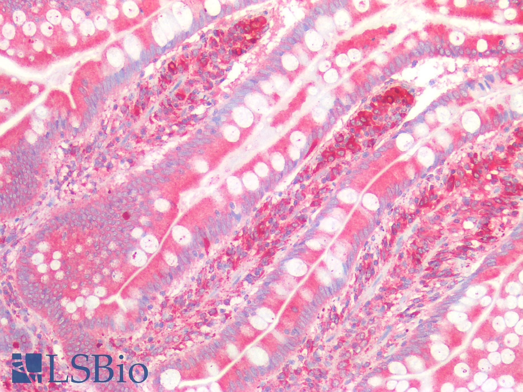 PathPlus™ Polyclonal Rabbit anti-Human CTSD / Cathepsin D Antibody (aa72-292, IHC, WB)
