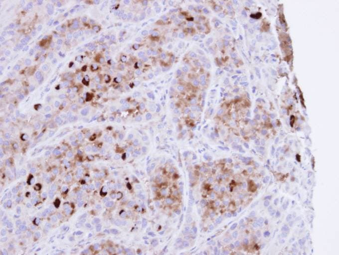 Polyclonal Rabbit anti-Human CARHSP1 Antibody (aa1-147, IHC, WB)
