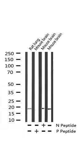 Polyclonal Rabbit anti-Human SNCA / Alpha-Synuclein Antibody (phospho-Tyr133, WB)