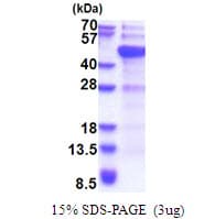 Human DNMT3L Protein (Recombinant His)