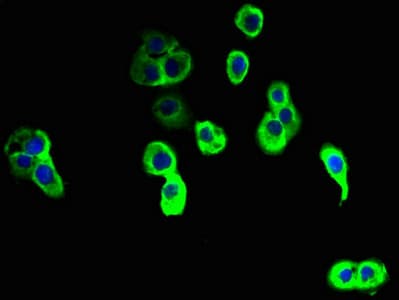NINJ2 / Ninjurin 2 Antibody