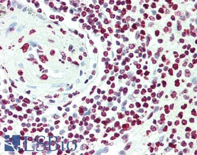 IHC-plus™ ICSBP / IRF8 Antibody (aa1-50)