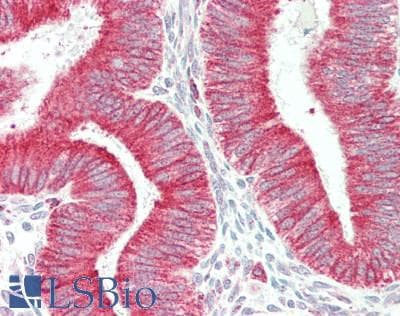IHC-plus™ Polyclonal Rabbit anti-Human RTN3 / Reticulon 3 Antibody (aa750-800, IHC, WB)