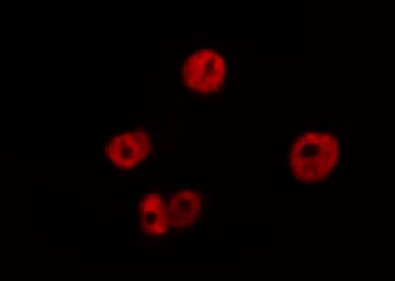 MCM3AP / GANP Antibody