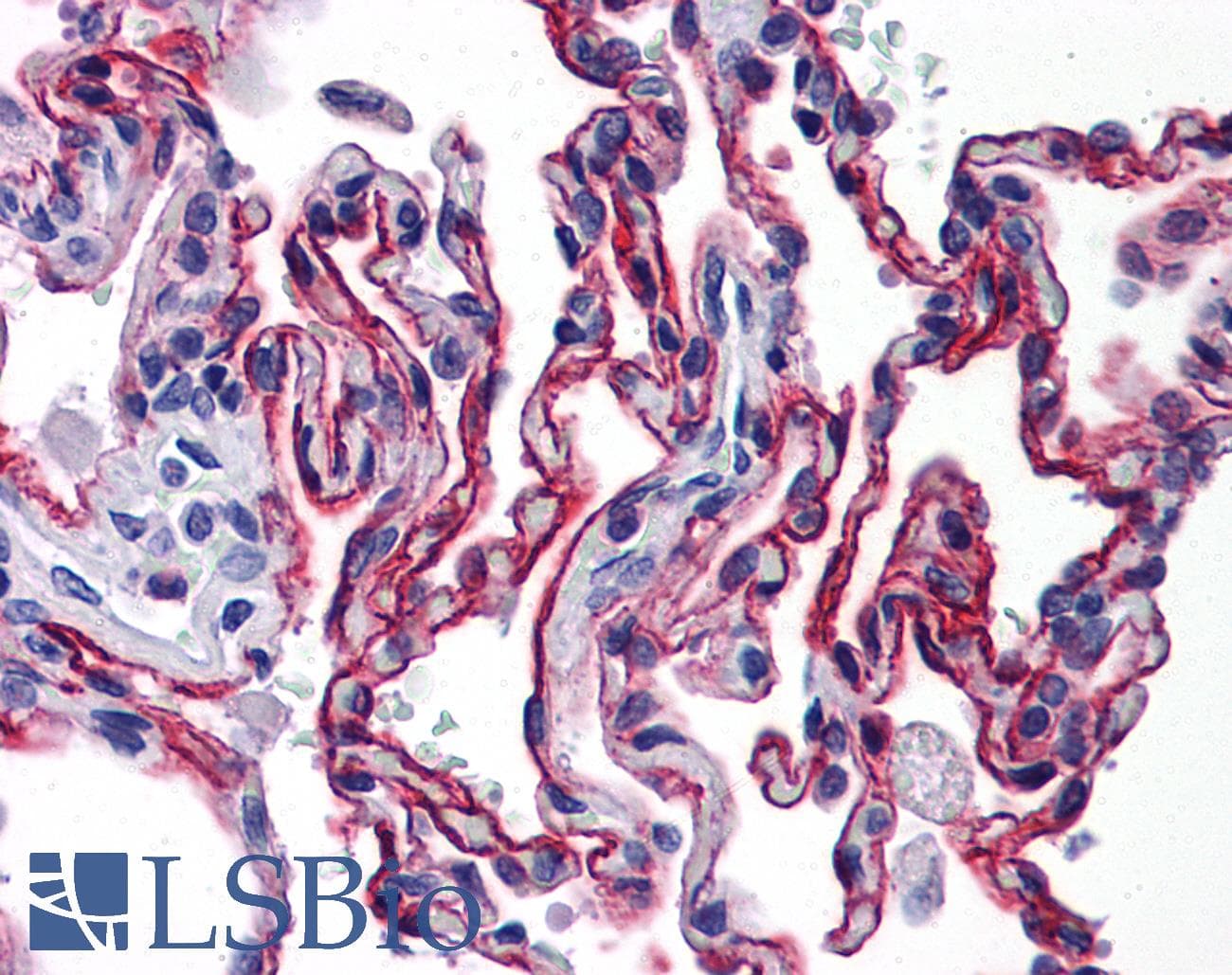 IHC-plus™ Monoclonal Mouse anti-Human AGER / RAGE Antibody (clone 1C1, aa23-405, IHC, WB)