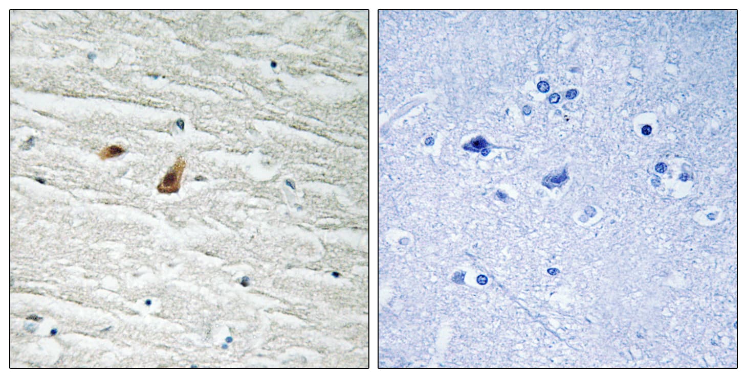 Polyclonal Rabbit anti-Human C/EBP Epsilon / CEBPE Antibody (phospho-Thr74, IHC, IF, WB)