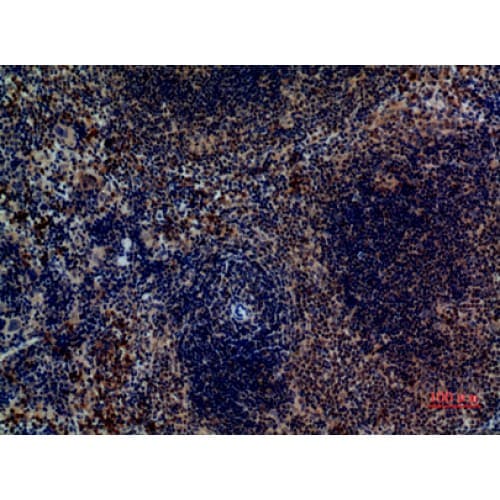Polyclonal Rabbit anti-Human PAX5 Antibody (161-210 aa, Internal, IHC, WB)
